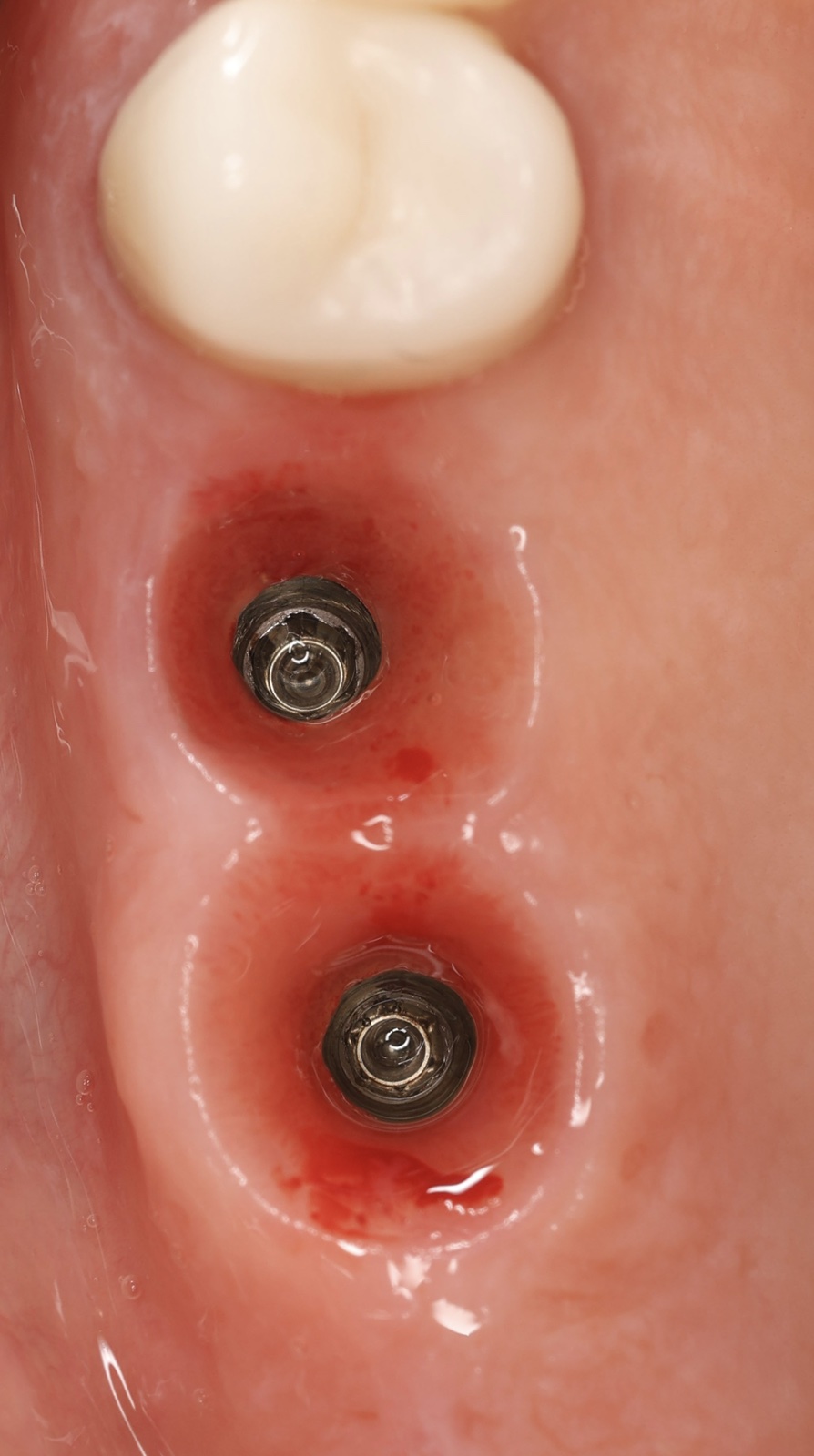 За MegaGen България